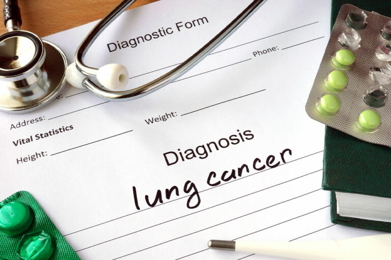 3 crucial tips for managing lung cancer