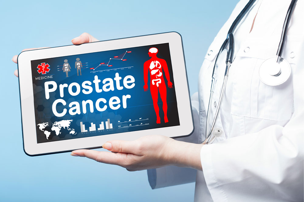 3 tips to help prevent and manage prostate cancer