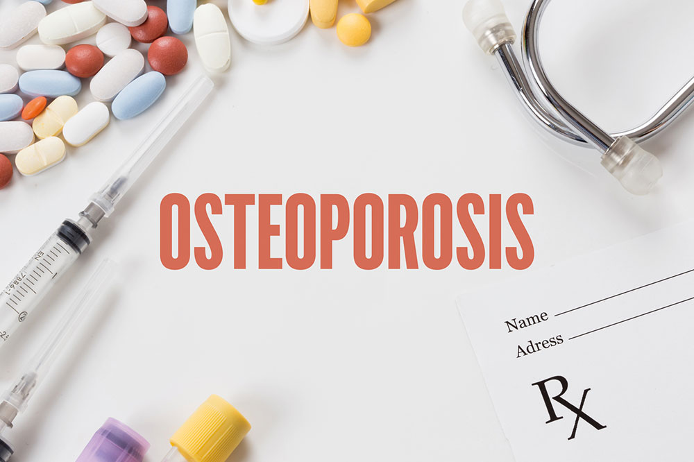 7 Conditions That Increase the Risk of Osteoporosis