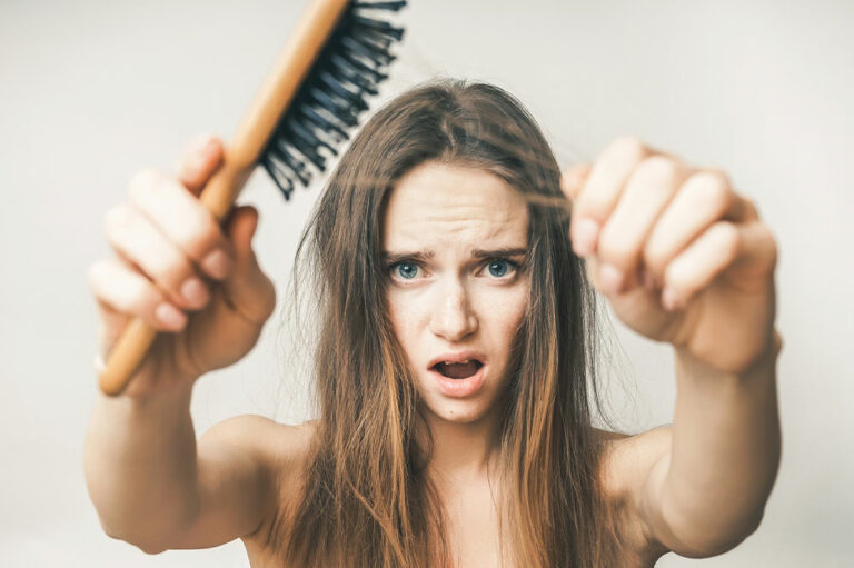 5 Conditions That Can Trigger Hair Loss