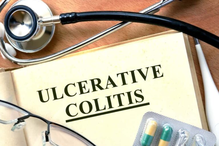 10 early signs of ulcerative colitis to not ignore